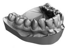 Teeth 3D Scanning Service Europac 3D